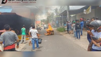 Adek Bermain Korek Api, Kakak mengalami Luka Bakar.